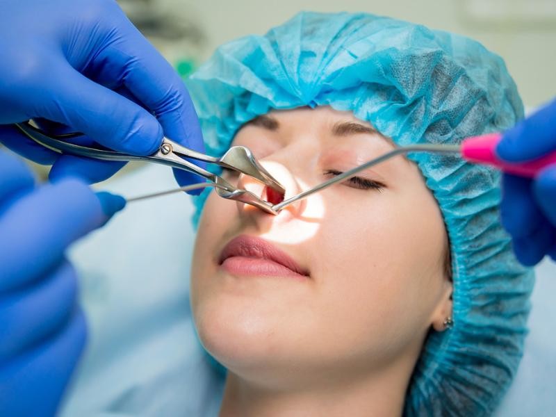 Cirurgia endoscópica nasal e sinusite - Dra. Marília Ferreira